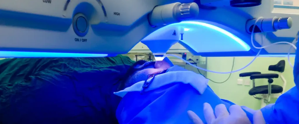 Paciente siendo sometido a una cirugía refractiva láser para corregir defectos refractivos como miopía, hipermetropía y astigmatismo.